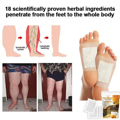 Bee Venom  Advanced Detox & Slim Foot Patch (Buy 1 Get 1) 🐝➕