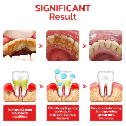 Sp-4 Breath Toothpaste Brightening & Stain Removing Toothpaste